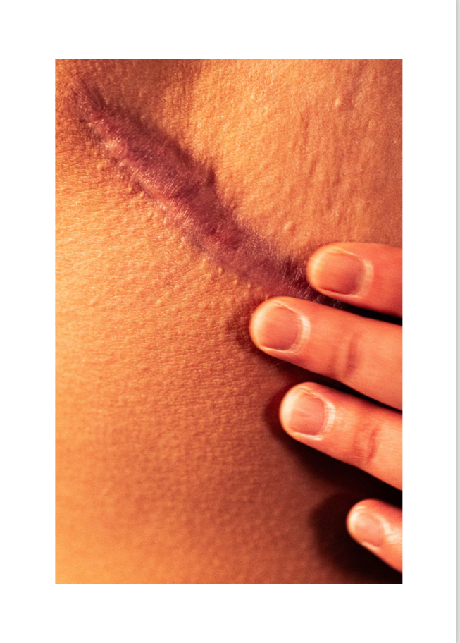 Cross All Borders 2024: New Visual Artist with&nbsp;Disabilities